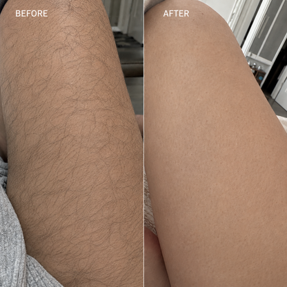 Snatched Hair Removal Cream